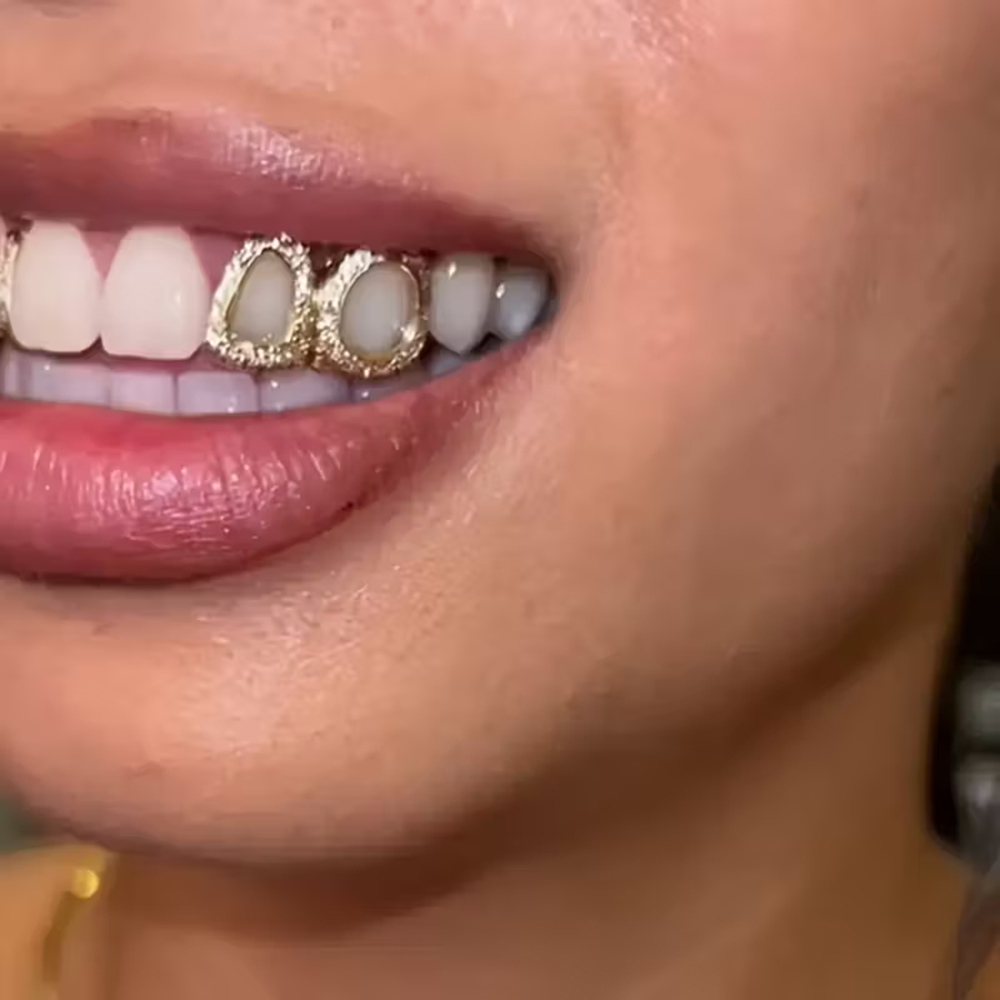 เครื่องประดับฟันแบบกลวงเงาวาวส - Street Fashion Jewelry บทวิจารณ์และราคา